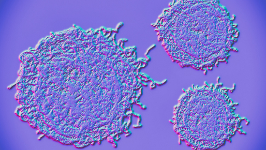 Gianneschi undruggable cancer proteins